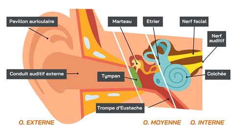 Schéma comparant le port d'une boucle à gauche, à droite et aux deux oreilles