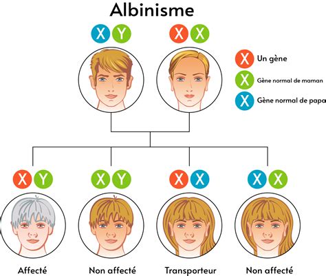 Infographie expliquant les bases de l'albinisme et les défis sociaux associés