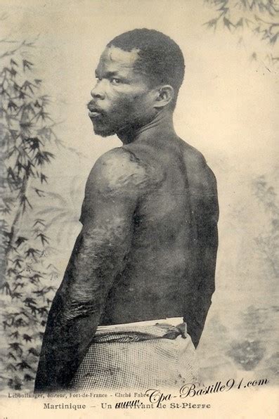 Photo de Louis-Auguste Cyparis, l'un des survivants de la catastrophe