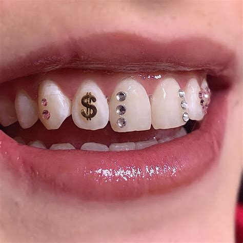 Infographie comparant les différents types de bijoux dentaires : strass, grillz, dents du bonheur.