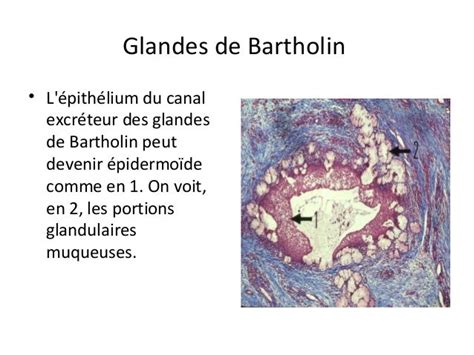 Schéma des glandes de Bartholin situées à l'entrée du vagin