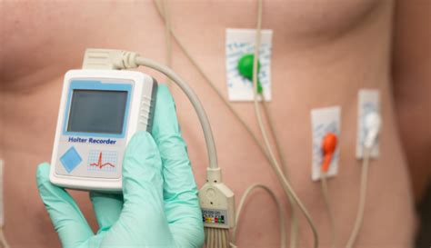 Illustration d'un boîtier de Holter cardiaque et d'électrodes