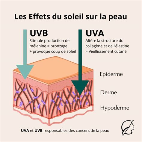 Schéma comparatif des effets du soleil sur différentes pierres naturelles